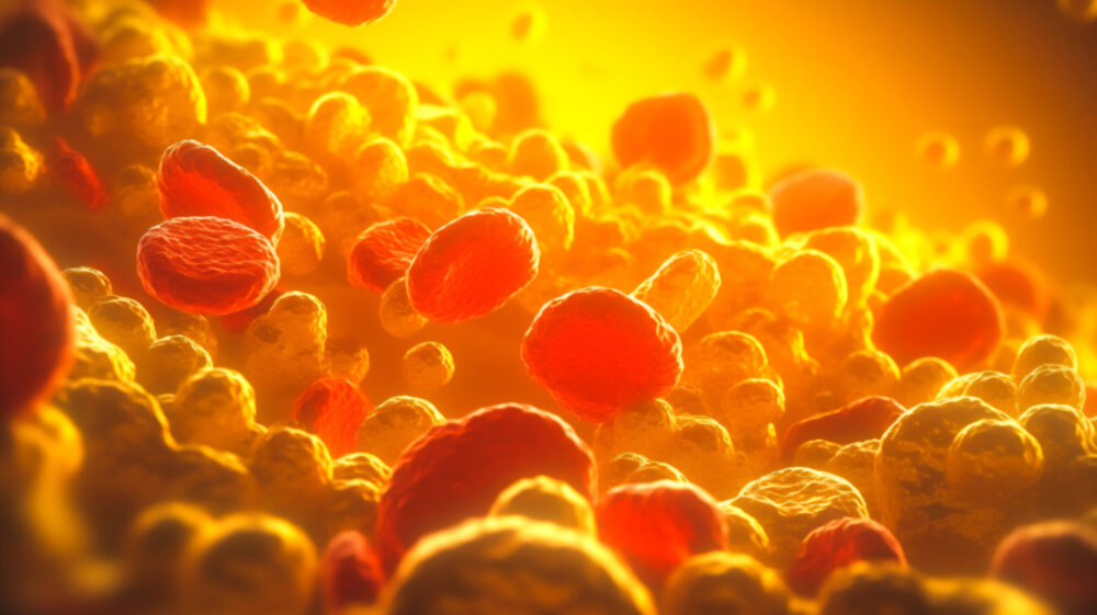 Appetite for Change: The Obesity Epidemic Meets Biotech